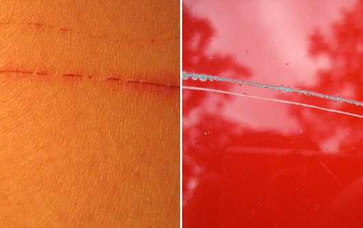 skin car scratch